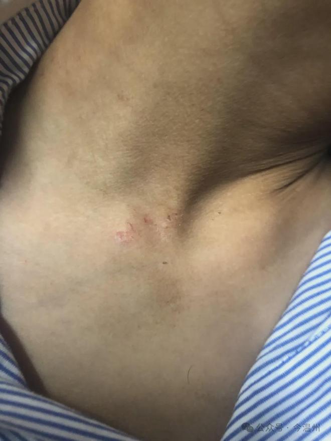 某被拘留更多细节透露OG真人瑞安教师林某(图4) 某被拘留更多细节透露OG真人瑞安教师林某(图4)